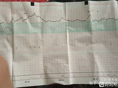 胎心监护结果解释 案例解释 知乎