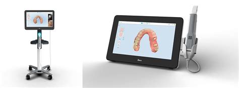 ITERO DIGITAL SCANNER Erin Hills Dental Erin ON Welcome