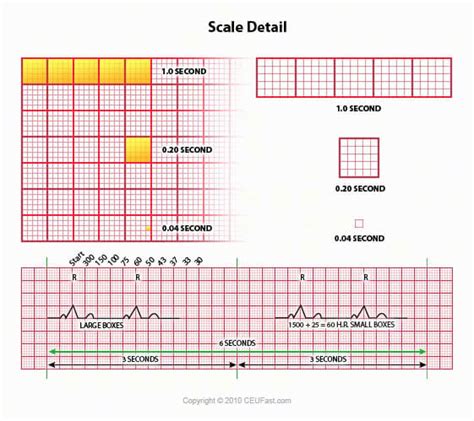 Ekg Ecg Interpretation Course Ceufast Nursing Continuing Education