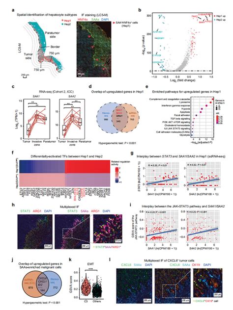 Cell Res Stereo Seq揭示人类肝癌浸润区促进肝细胞 肿瘤细胞串扰、局部免疫抑制和肿瘤进展 知乎