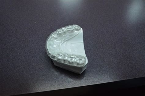 teeth grinding university dental care cosmetic family dentist