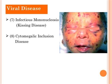 Viral Diseases 3