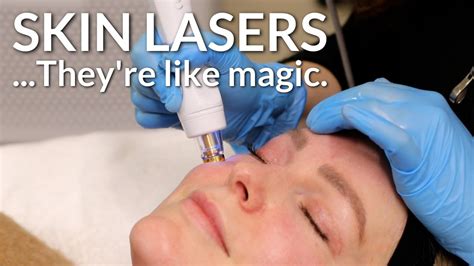 Tight Bright An Amazing Combination Laser Treatment Lucere Skin