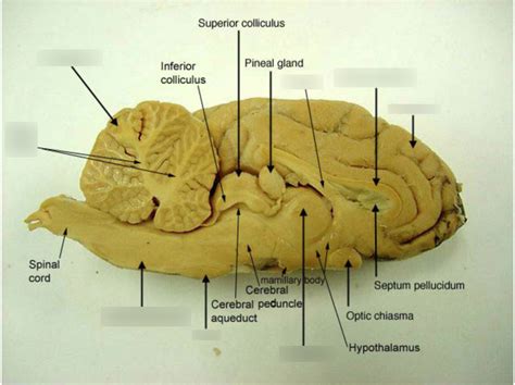 Sagittal Section Sheep Brain Diagram Quizlet