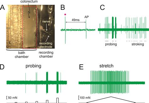 In Vitro Functional Characterization Of Mouse Colorectal Afferent