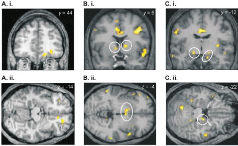 Neural Activations Evoked By Appetitive Olfactory Learning A In The