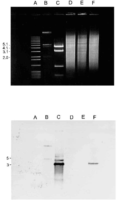 Southern Hybridization Analysis Using The Kb Hindiii Bamhi Gal