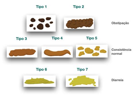 Escala De Bristol Avaliar A Consistência Das Fezes