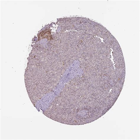 Tissue Expression Of CXCR5 Staining In Spleen The Human Protein Atlas