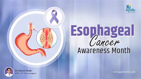 April Is Esophageal Cancer Awareness Month Dr Harsh Shah