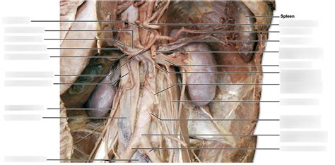 Anatomy Lab Ventral Body Cavity Arteries Veins Diagram Quizlet