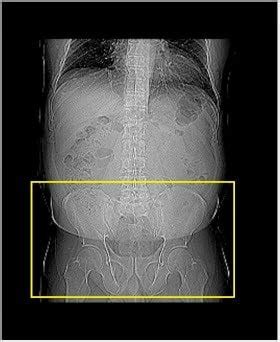 Learn CT Today Abdomen Pelvis CT Rad Tech EDU