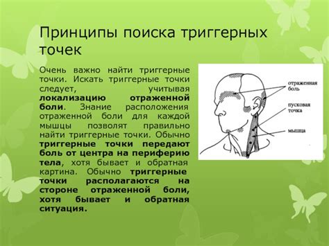 Триггерные точки