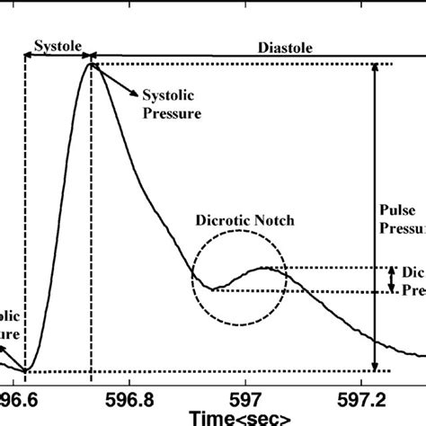 A Parameterized Abp Waveform Including Systole And Diastole Regions