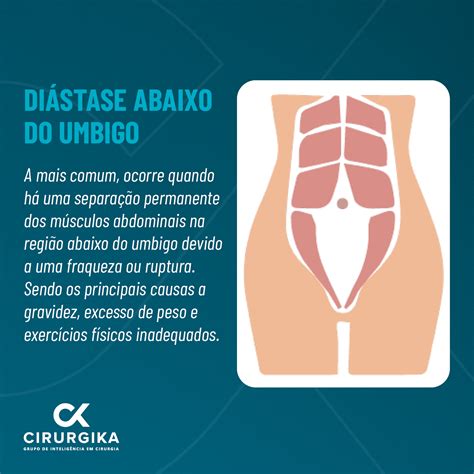 Di Stase Abdominal Entenda O Que E Suas Principais Causas Cl Nica