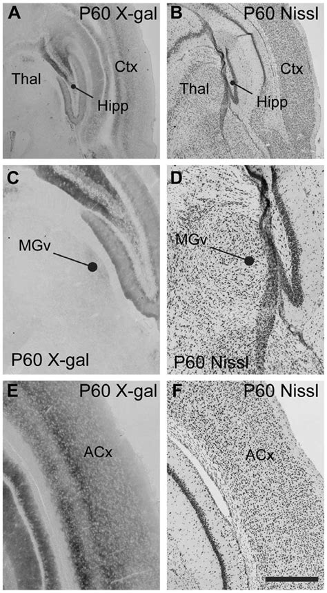 Expression Of EphB2 In Auditory Pathways At P60 A Coronal Section