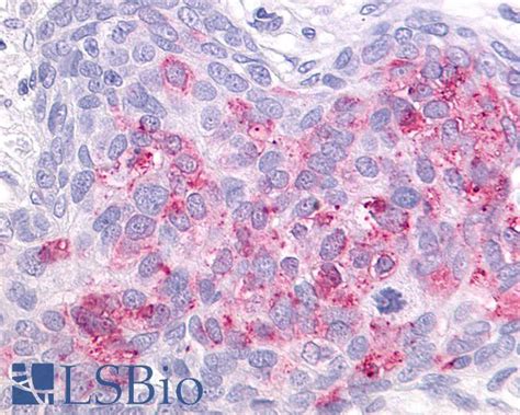 Pathplus Gpr Polyclonal Antibody Rabbit Anti Human Ihc Lsbio