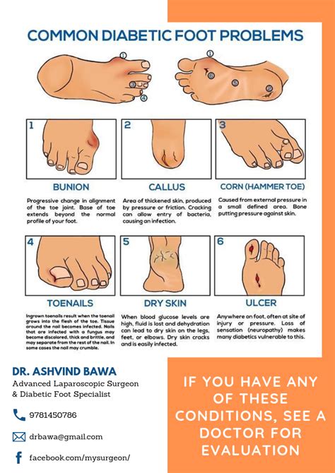 Common Diabetic Foot Problems Common Diabetic Foot Problems By Dr