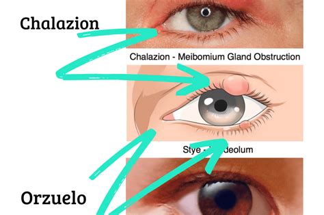 Manual Directorio Transferencia De Dinero Orzuelo En El Ojo Causas Y