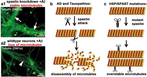 Spastin Executes Microtubule Loss After Invasion Of Dendrites By Tau