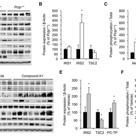 Genetic Ablation Or Pharmacological Inhibition Of PC TP Promotes