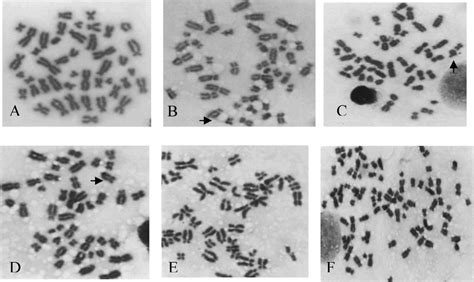 Metaphases Spread From Bone Marrow Cells Of F4 Transgenic Rabbit Download Scientific Diagram