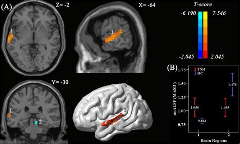Frontiers | Abnormal Spontaneous Neural Activity of the Central