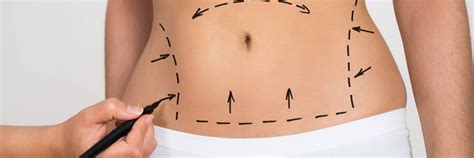 Soluciones Para Eliminar La Celulitis En El Abdomen Iml