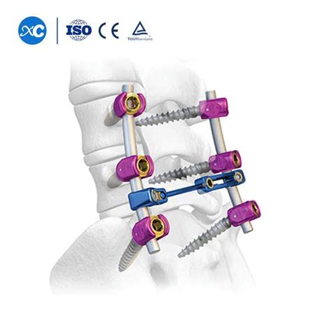 Spinal Fixation System Spinal Lumber Implants Polyaxial Titanium