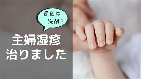 主婦湿疹・手湿疹が治らないのは洗剤が原因かも？私の治った体験談｜しろあんブログ