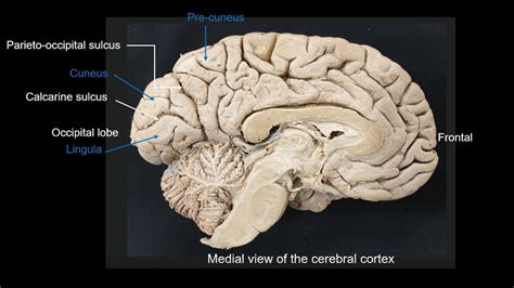 Parietooccipital Sulcus - Asking List