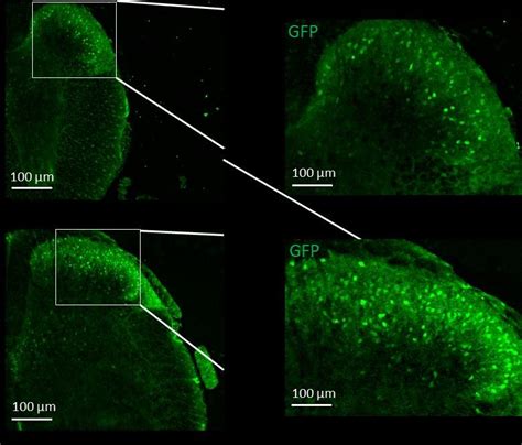 Expression de la ChR2 EYFP dans la moelle épinière A B Amplification