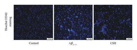 Effects Of Csh On Ros Levels And Apoptosis In A Induced Ht