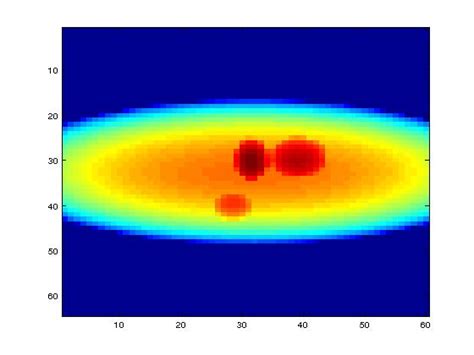 Cone Beam Reconstruction Using Matlab The Best Picture Of Beam