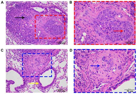 Generation And Identification Of A Thyroid Cancer Cell Line With Stable