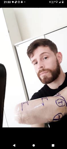 Amputee Gay Stump Image ThisVid Tube