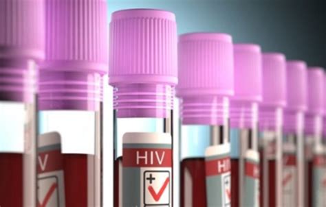 O que fazer após receber o diagnóstico de HIV Planeta