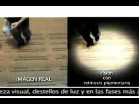 As Ve Una Persona Con Retinosis Pigmentar A Youtube