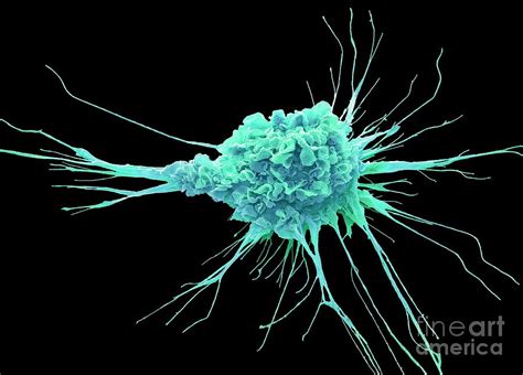 Dendritic Cell 3 By Science Photo Library