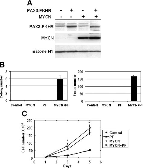 High Expression Of The PAX3 FKHR Oncoprotein Is Required To Promote