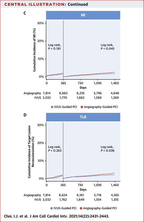 Impact Of Intravascular Ultrasound On Long Term Clinical Outcomes In