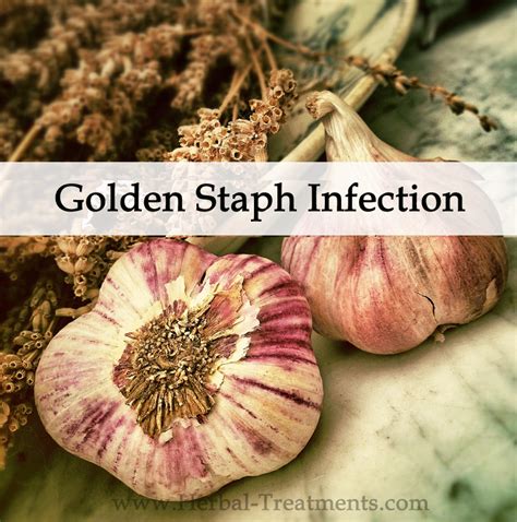 Herbal Medicine Program for Golden Staph Infection - Caraf Avnayt's ...