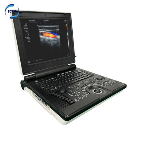 Portable Inch Color Doppler Ultrasonic Diagnostic System Laptop