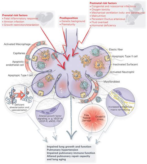 Nursing Pathophysiology Of Lung Cancer Diagram