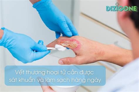 Vết thương hoại tử có biểu hiện gì 7 điều cần biết để xử lý hiệu quả