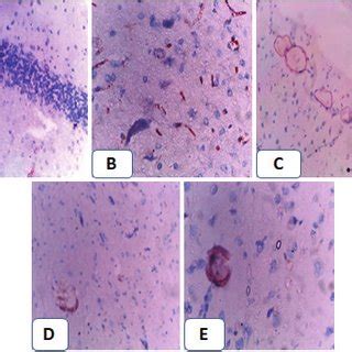 Photograph for myeloperoxidase immunohistochemical staining of brain ...