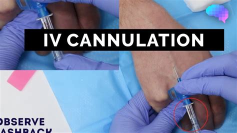 Intravenous Iv Cannulation Osce Guide Ukmla Cpsa Plab 2 Youtube