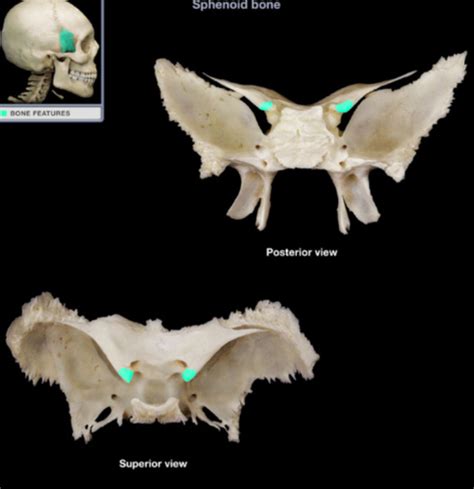 Sphenoid And Ethmoid Bone Flashcards Quizlet