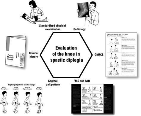 Management of the Knee in Spastic Diplegia: What is the Dose ...