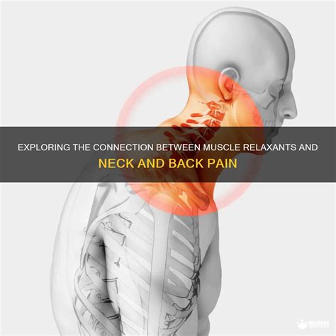 Exploring The Connection Between Muscle Relaxants And Neck And Back Pain | MedShun